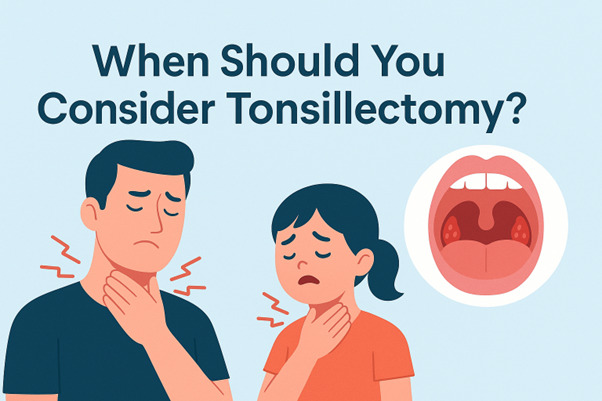 When Should You Consider Tonsillectomy